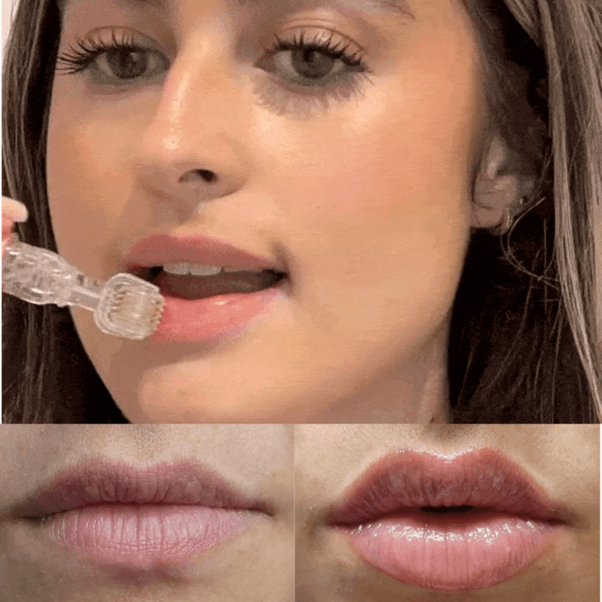 KissVibeâ„¢ Plump Lips Kit