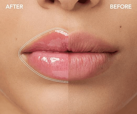 KissVibeâ„¢ Plump Lips Kit