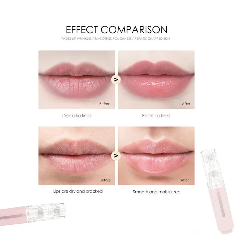 KissVibeâ„¢ Plump Lips Kit