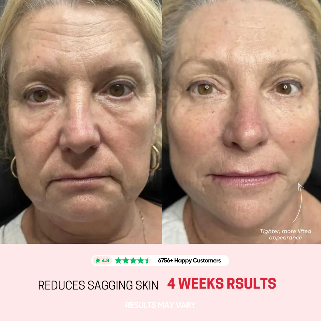 Avora Lift - Skin Tightening Massager