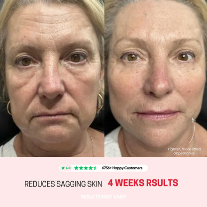 Avora Lift - Skin Tightening Massager