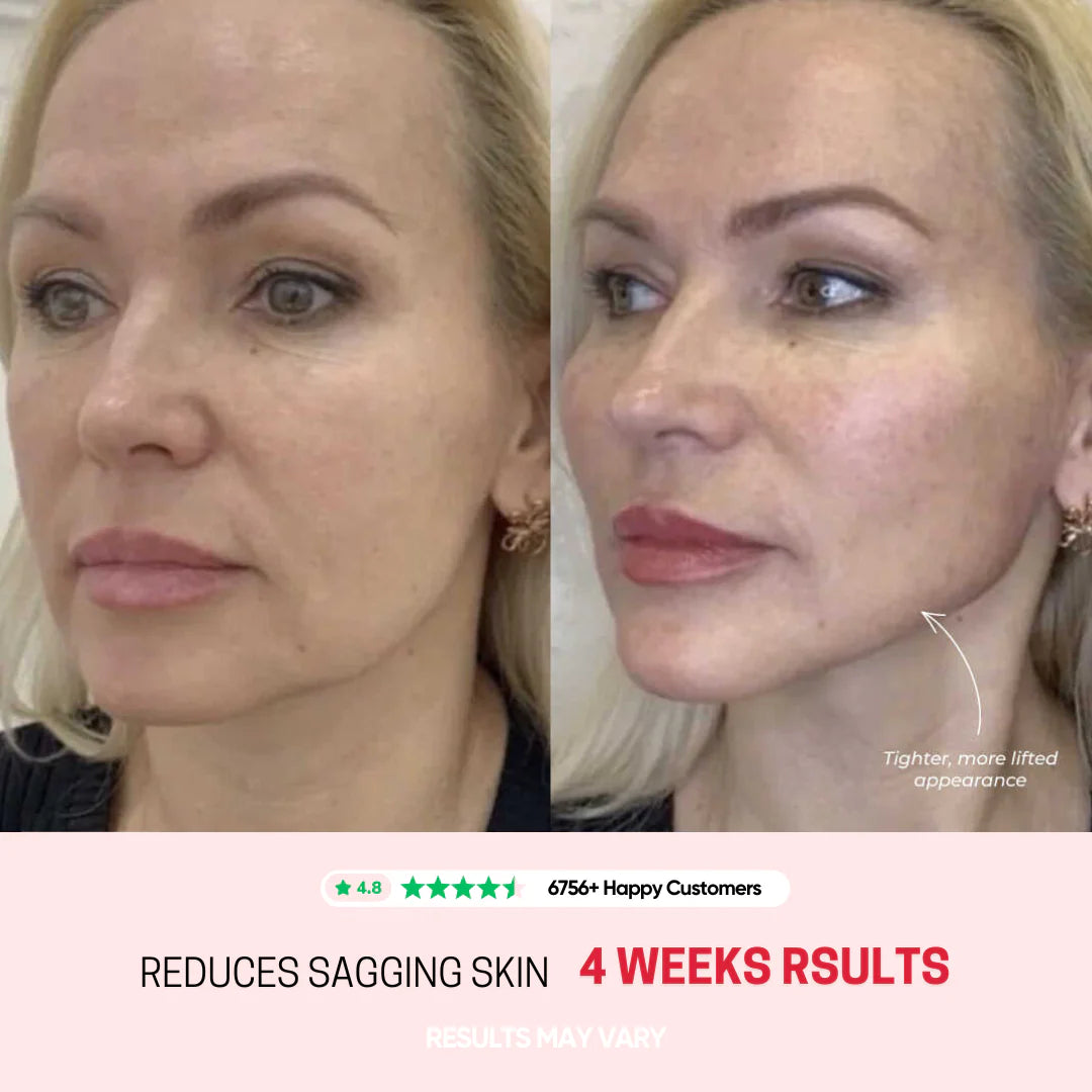 Avora Lift - Skin Tightening Massager