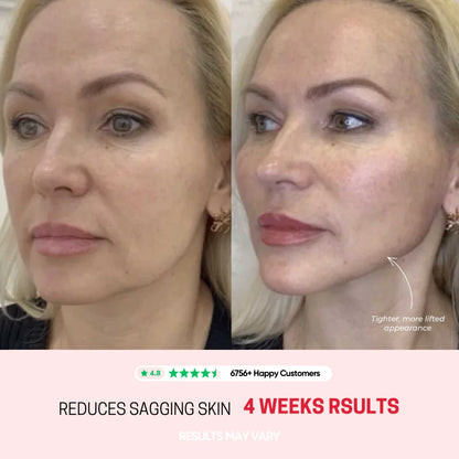 Avora Lift - Skin Tightening Massager