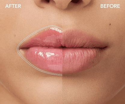 KissVibe™ Plump Lips Kit